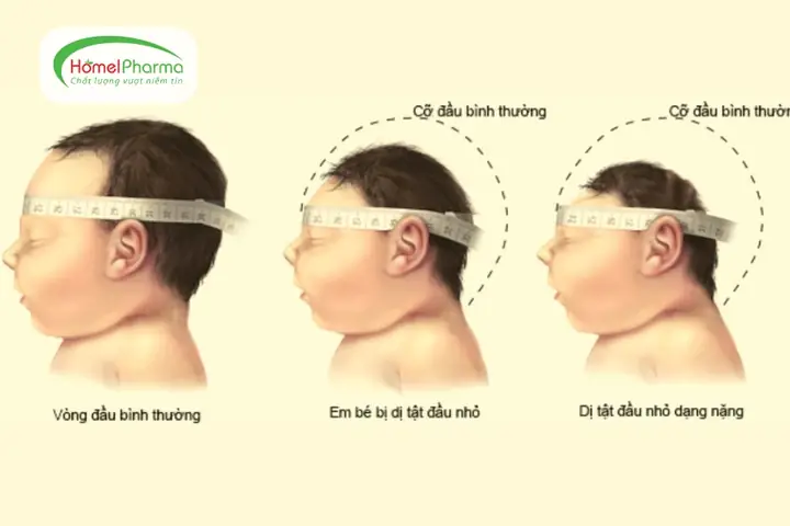 Bảng Đo Vòng Đầu Trẻ Sơ Sinh: Chuẩn Who & Cách Theo Dõi Đúng Từ 0-36 Tháng