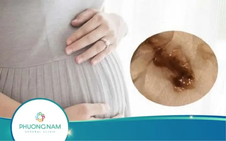 Bầu 3 Tháng Đầu Bị Ra Dịch Nâu: Nguyên Nhân, Dấu Hiệu Nguy Hiểm & Cách Xử Trí An Toàn Bầu 3 Tháng Đầu Bị Ra Dịch Nâu: Nguyên Nhân, Dấu Hiệu Nguy Hiểm & Cách Xử Trí An Toàn