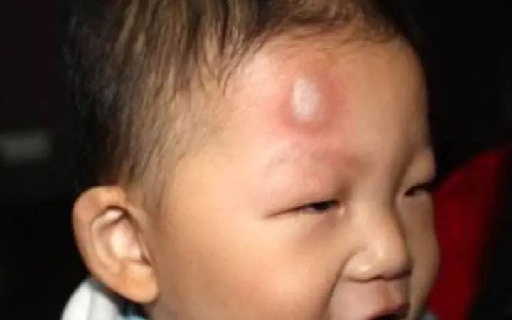 Bé 2 Tuổi Bị Té Đập Đầu Xuống Đất: Dấu Hiệu Nguy Hiểm Và Cách Xử Trí Đúng