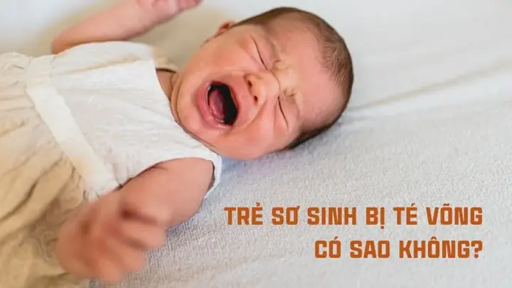 Bé 3 Tháng Tuổi Bị Té Võng: Cách Xử Lý, Dấu Hiệu Nguy Hiểm Và Phòng Ngừa