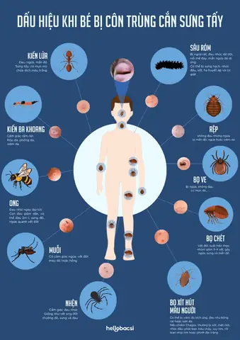 Bé Bị Muỗi Cắn Sưng Đỏ: Nguyên Nhân, Cách Xử Lý Nhanh Và Dấu Hiệu Nguy Hiểm Cần Biết