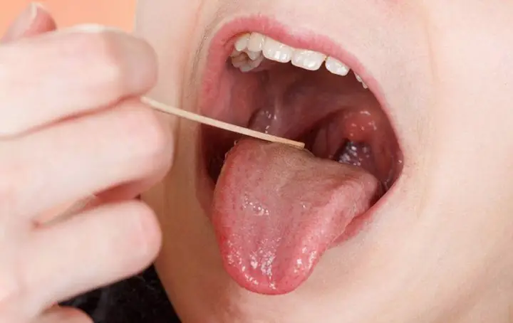 Bé Bị Nổi Hạt Trong Họng: Nguyên Nhân, Dấu Hiệu & Cách Chữa Trị An Toàn