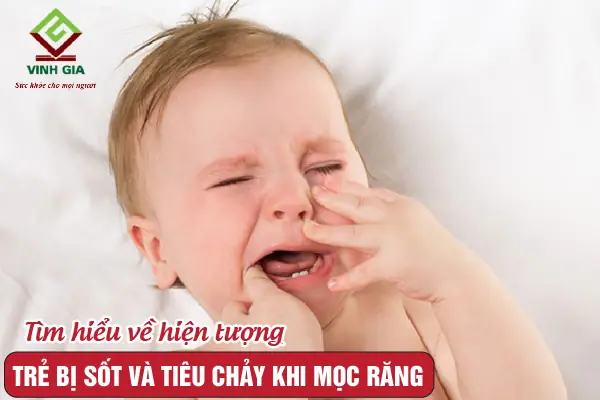 Bé Mọc Răng Sốt Tiêu Chảy: Dấu Hiệu, Nguyên Nhân Và Cách Xử Lý An Toàn Cho Bé