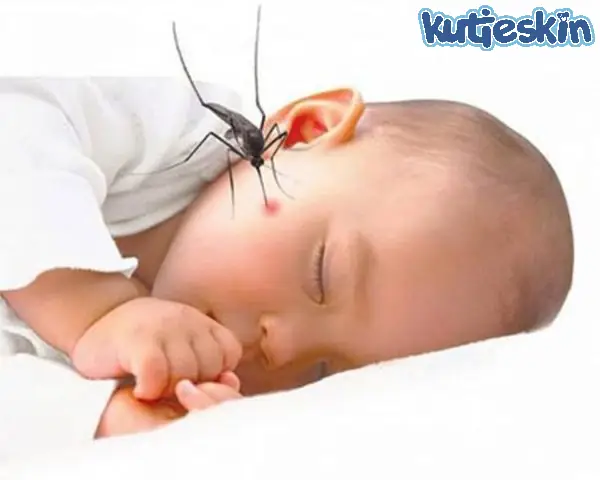 Trẻ Sơ Sinh Bị Muỗi Đốt Phải Làm Sao? Hướng Dẫn Xử Lý An Toàn & Hiệu Quả Trẻ Sơ Sinh Bị Muỗi Đốt Phải Làm Sao? Hướng Dẫn Xử Lý An Toàn & Hiệu Quả