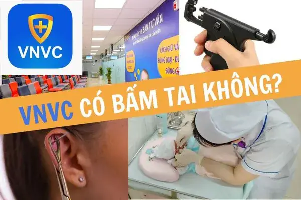 Top Bệnh Viện Uy Tín Thực Hiện Dịch Vụ Bấm Lỗ Tai An Toàn, Chất Lượng