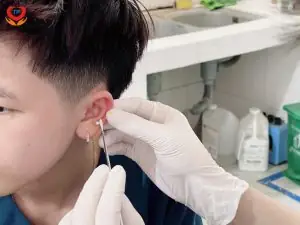 Top Bệnh Viện Uy Tín Thực Hiện Dịch Vụ Bấm Lỗ Tai An Toàn, Chất Lượng
