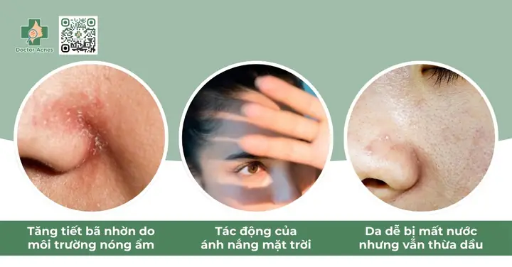 Bước Chăm Sóc Da Dầu Mụn Mùa Hè Chuẩn, Giúp Da Sạch Mụn & Kiềm Dầu Hiệu Quả