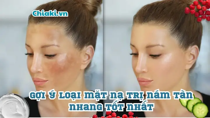 Top 10+ Các Loại Mặt Nạ Trị Nám Tự Nhiên & Dược Phẩm Hiệu Quả Nhất Tại Nhà Top 10+ Các Loại Mặt Nạ Trị Nám Tự Nhiên & Dược Phẩm Hiệu Quả Nhất Tại Nhà