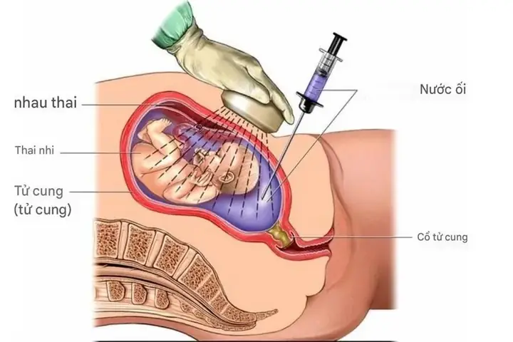 Mẹ Bầu Uống Gì, Ăn Gì Để Tăng Nước Ối Nhanh Chóng Và An Toàn? Mẹ Bầu Uống Gì, Ăn Gì Để Tăng Nước Ối Nhanh Chóng Và An Toàn?