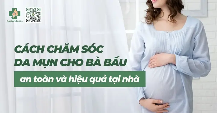 Chăm Sóc Da Mụn Cho Bà Bầu An Toàn Và Hiệu Quả: Hướng Dẫn Chi Tiết Từ Chuyên Gia