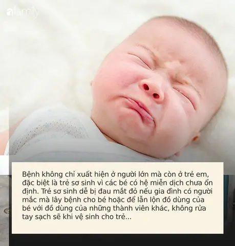 Hướng Dẫn Cách Chữa Trị Đau Mắt Ở Trẻ Sơ Sinh Hiệu Quả Và An Toàn Hướng Dẫn Cách Chữa Trị Đau Mắt Ở Trẻ Sơ Sinh Hiệu Quả Và An Toàn