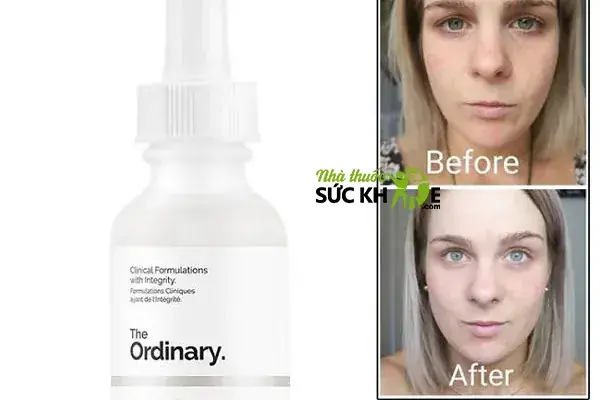 Hướng Dẫn Chi Tiết Cách Dùng The Ordinary Niacinamide 10% + Zinc 1% Hiệu Quả Tối Ưu