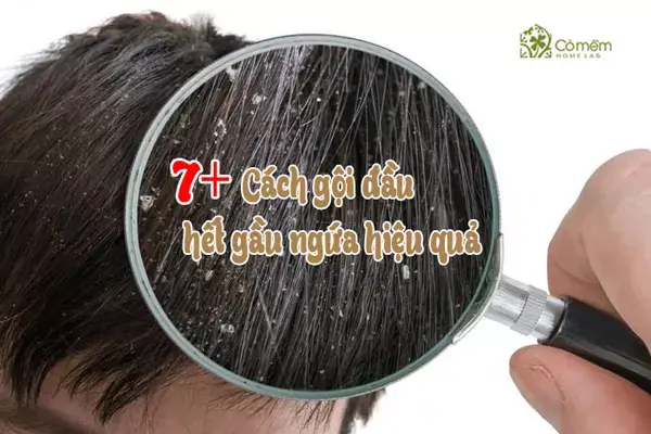 Cách Gội Đầu Hết Gàu Hiệu Quả & Ngăn Ngừa Tái Phát: Hướng Dẫn Chi Tiết Từ Chuyên Gia