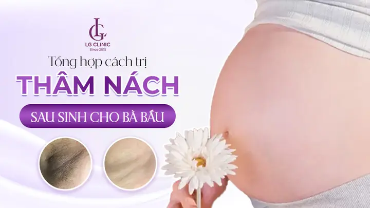Cách Hơ Nách Sau Sinh: Bí Quyết Giảm Mùi Hiệu Quả Cho Mẹ Bỉm