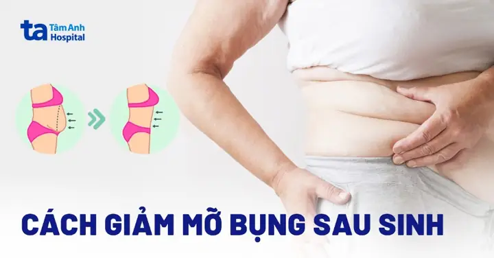 Lấy Lại Vóc Dáng: Bí Quyết Làm Bụng Nhỏ Lại Sau Sinh Mổ An Toàn Và Hiệu Quả Cho Mẹ Bỉm