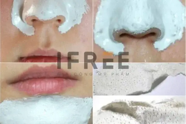 8+ Công Thức Làm Keo Lột Mụn Tự Nhiên Tại Nhà Hiệu Quả & An Toàn
