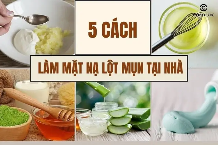 10 Công Thức Mặt Nạ Lột Mụn Đầu Đen Tại Nhà Đơn Giản, Hiệu Quả Tức Thì