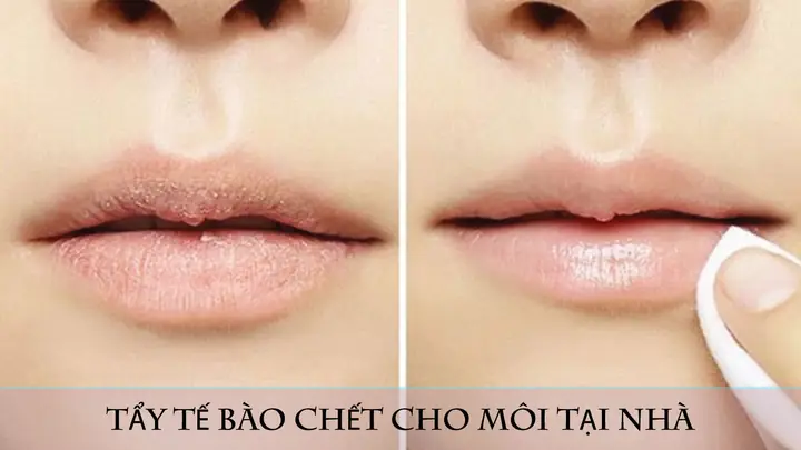 Hướng Dẫn Tự Làm Mặt Nạ Tẩy Tế Bào Chết Cho Môi Chuẩn Spa Tại Nhà