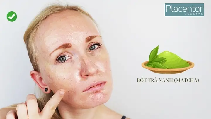 Hướng Dẫn Tự Làm Sữa Rửa Mặt Từ Bột Trà Xanh: Bí Quyết Làm Sạch Và Dưỡng Da Tại Nhà