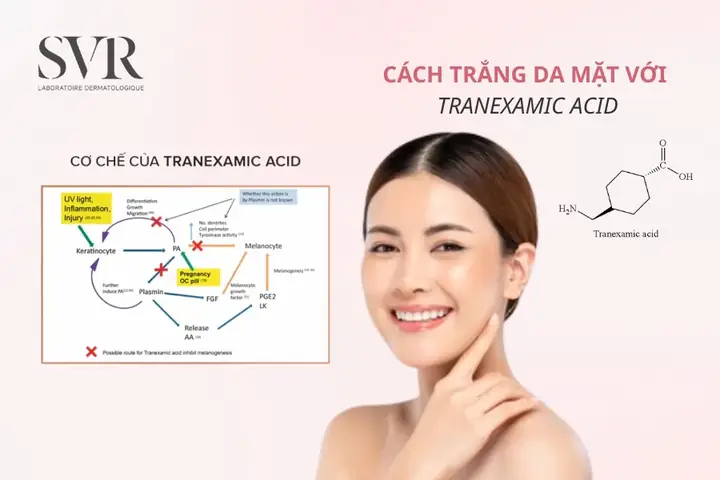 Tạm Biệt Nám: Bí Quyết Làm Trắng Da Toàn Diện & Đánh Bay Vết Nám Lâu Năm Tại Nhà Tạm Biệt Nám: Bí Quyết Làm Trắng Da Toàn Diện & Đánh Bay Vết Nám Lâu Năm Tại Nhà