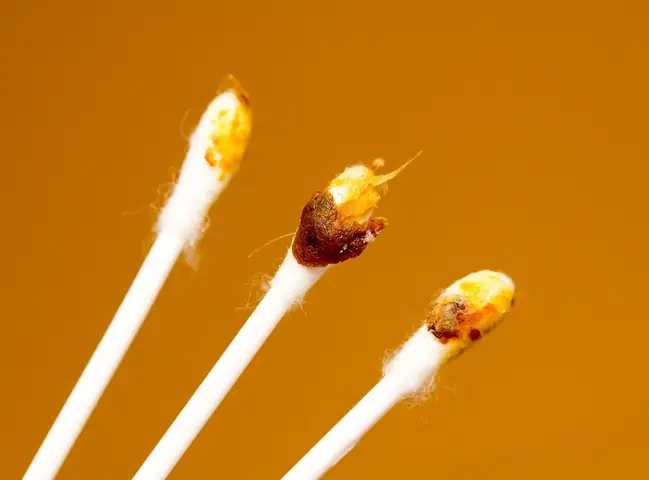 Hướng Dẫn Lấy Ráy Tai An Toàn & Hiệu Quả Tại Nhà Cho Mọi Lứa Tuổi Hướng Dẫn Lấy Ráy Tai An Toàn & Hiệu Quả Tại Nhà Cho Mọi Lứa Tuổi