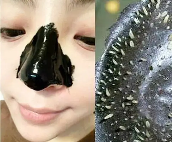 Hướng Dẫn Chi Tiết Cách Lột Mụn Bằng Than Tre An Toàn Và Hiệu Quả Tại Nhà Hướng Dẫn Chi Tiết Cách Lột Mụn Bằng Than Tre An Toàn Và Hiệu Quả Tại Nhà