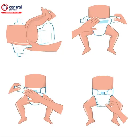 Hướng Dẫn Chi Tiết Cách Mặc Quần Đóng Bỉm Cho Bé Chuẩn Chỉnh, Không Tràn & Thoải Mái Hướng Dẫn Chi Tiết Cách Mặc Quần Đóng Bỉm Cho Bé Chuẩn Chỉnh, Không Tràn & Thoải Mái
