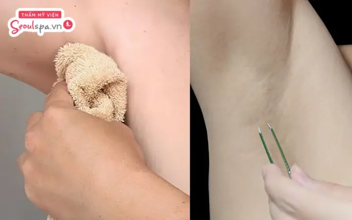 Cách Nhổ Lông Nách Không Đau, Không Thâm: Bí Quyết Sở Hữu Vùng Da Mịn Màng Tự Nhiên