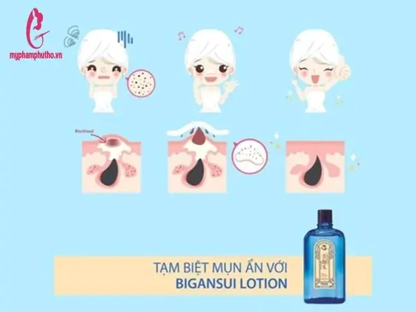 Cách Sử Dụng Nước Hoa Hồng Trị Mụn Nhật Bản Hiệu Quả Nhất: Hướng Dẫn Chi Tiết Từ A-z Cách Sử Dụng Nước Hoa Hồng Trị Mụn Nhật Bản Hiệu Quả Nhất: Hướng Dẫn Chi Tiết Từ A-z