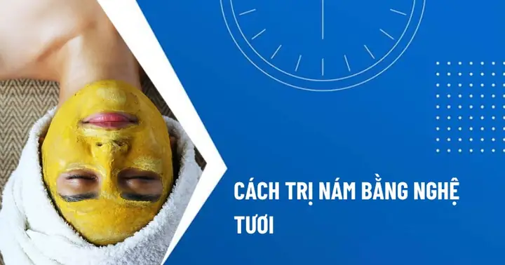 Cách Trị Nám Sau Sinh Bằng Nghệ Tươi: Bí Quyết An Toàn & Hiệu Quả Tại Nhà Cách Trị Nám Sau Sinh Bằng Nghệ Tươi: Bí Quyết An Toàn & Hiệu Quả Tại Nhà