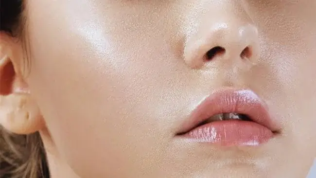 15 Cách Trị Da Mặt Nhờn Hiệu Quả Tại Nhà Đơn Giản, Không Tốn Kém