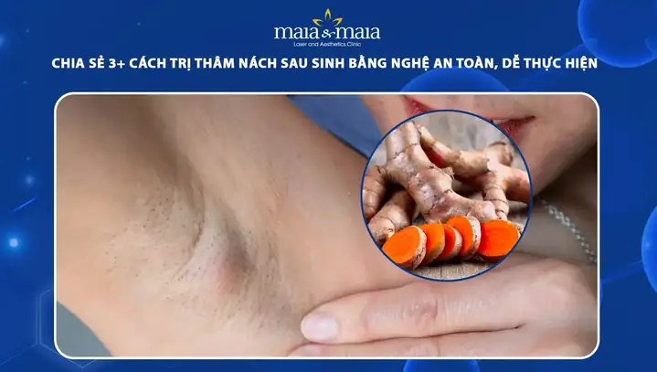 Cách Trị Thâm Nách Bằng Nghệ Tươi & Bột Nghệ: Bí Quyết Hiệu Quả Tại Nhà