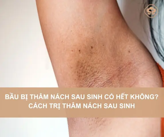 Bí Quyết Xoá Thâm Nách An Toàn Cho Bà Bầu: Nguyên Nhân Và Giải Pháp Hiệu Quả