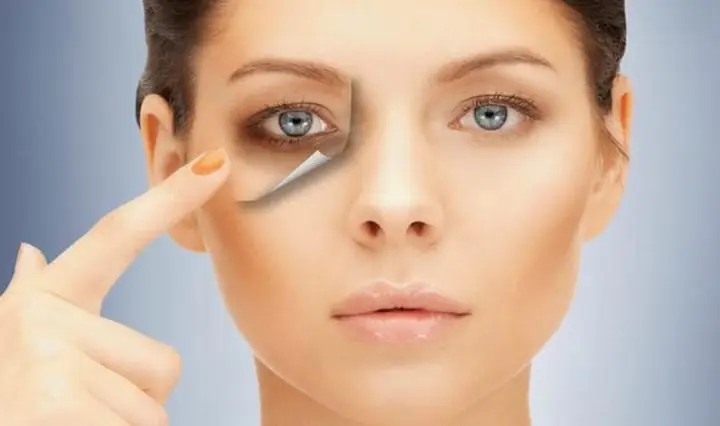 Mật Ong: "bí Quyết" Xóa Tan Quầng Thâm Mắt Tại Nhà Hiệu Quả