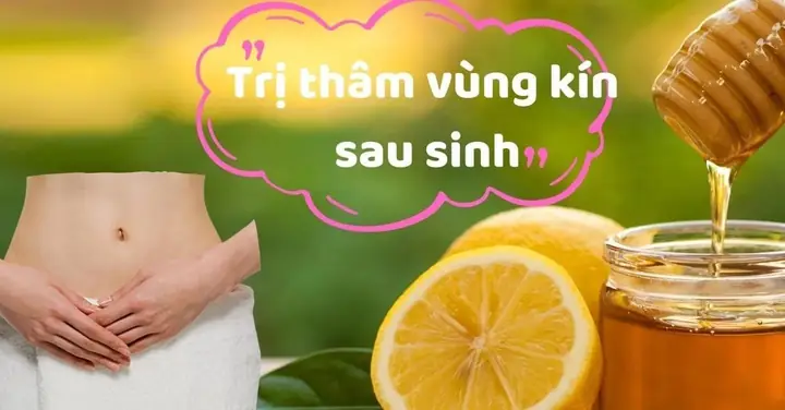 10 Cách Trị Thâm Sau Khi Sinh An Toàn, Hiệu Quả Tại Nhà Cho Mẹ Bỉm