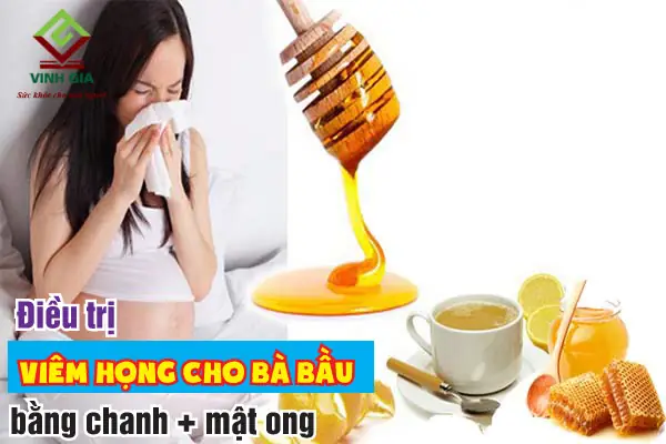 Cách Trị Viêm Họng Cho Bà Bầu An Toàn & Hiệu Quả: Giải Pháp Tự Nhiên & Y Tế
