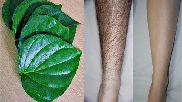 Cách Triệt Lông Tại Nhà Hiệu Quả, An Toàn & Không Gây Đau Rát
