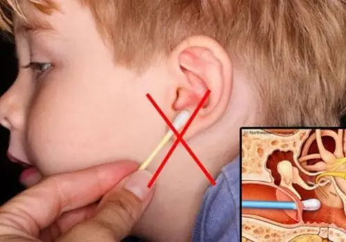 Cách Xử Lý Nhanh Chóng Khi Nước Vào Tai Trẻ Sơ Sinh An Toàn, Hiệu Quả