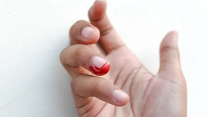 Cách Xử Lý Khi Cắt Móng Tay Cho Bé Bị Chảy Máu An Toàn & Nhanh Chóng