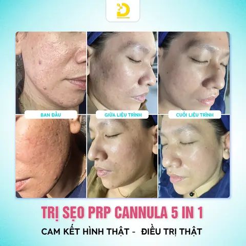 Top Spa & Thẩm Mỹ Viện Chăm Sóc Da Tốt Nhất Tp.hcm: Uy Tín & Chất Lượng Cập Nhật 2024