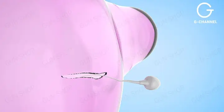 Chọc Thủng Bao Cao Su Như Thế Nào? Nguyên Nhân, Cách Xử Lý Và Phòng Tránh