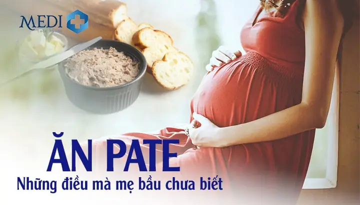 Bà Bầu Ăn Pate Được Không? An Toàn Và Lưu Ý Quan Trọng