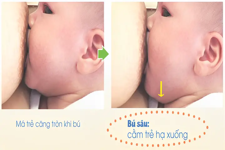Có Nên Cho Bé Bú Nằm? Hướng Dẫn Tư Thế An Toàn & Tránh Sặc Sữa