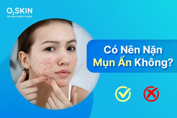 Mụn Ẩn Có Đẩy Lên Không? Khi Nào Nên Xử Lý Để Trị Mụn An Toàn?
