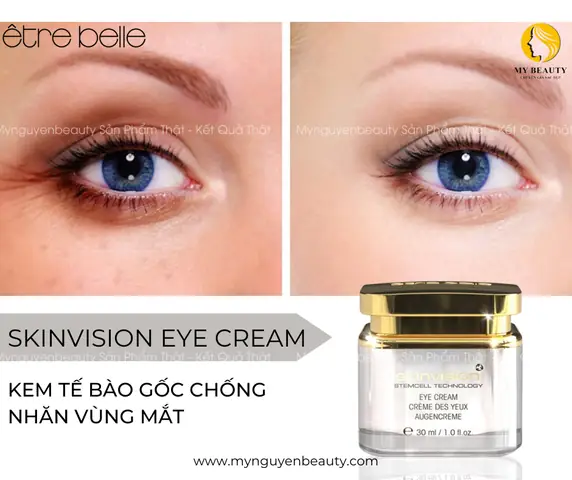 Có Nên Dùng Kem Dưỡng Mắt Không? Giải Mã Từ Chuyên Gia & Hướng Dẫn Chi Tiết