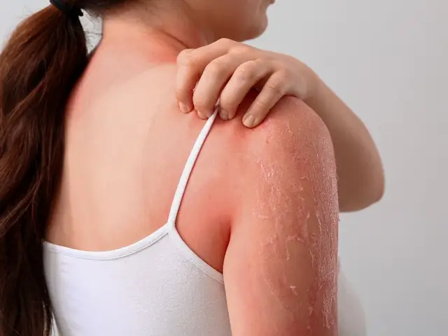 Có Nên Dùng Sữa Tắm Hàng Ngày Không? Lợi Ích, Rủi Ro & Cách Tắm Đúng Có Nên Dùng Sữa Tắm Hàng Ngày Không? Lợi Ích, Rủi Ro & Cách Tắm Đúng