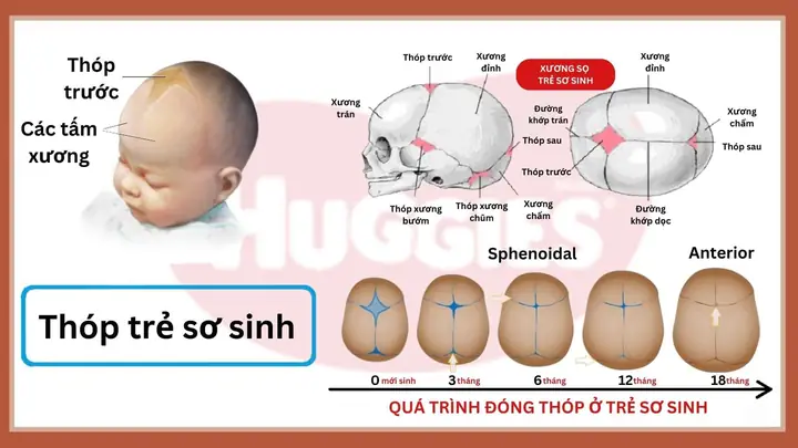 Có Nên Thoa Dầu Lên Thóp Trẻ Sơ Sinh Không? Hướng Dẫn Chăm Sóc An Toàn