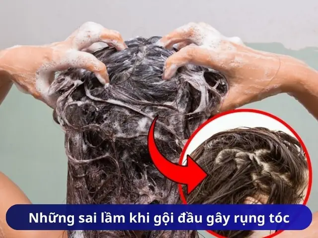 Cứ Gội Đầu Là Tóc Rụng Nhiều: Nguyên Nhân Nào & Khắc Phục Ra Sao?