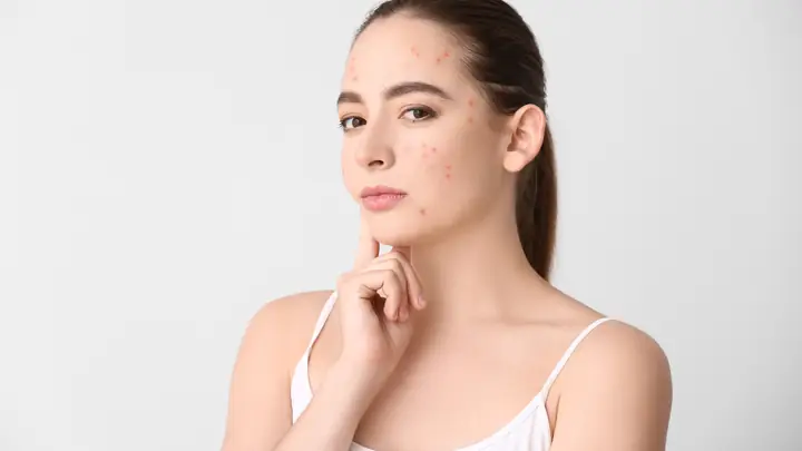 Da Hỗn Hợp Thiên Dầu Nên Đắp Mặt Nạ Gì Tốt Nhất? Bí Quyết Lỗ Chân Lông Thông Thoáng