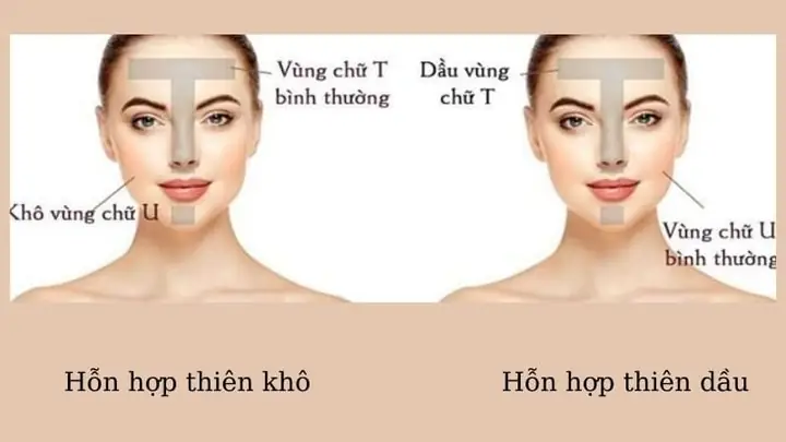 Da Hỗn Hợp Thiên Dầu Nên Dùng Serum Gì Tốt Nhất 2026: Top Lựa Chọn Giúp Kiềm Dầu, Dưỡng Ẩm, Thu Nhỏ Lỗ Chân Lông